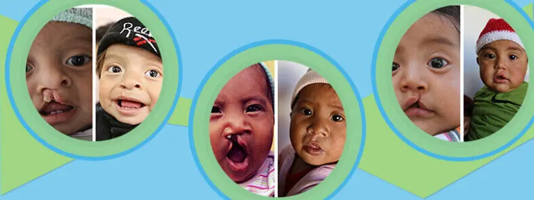 Medical Missions For Children Guatemala 2015