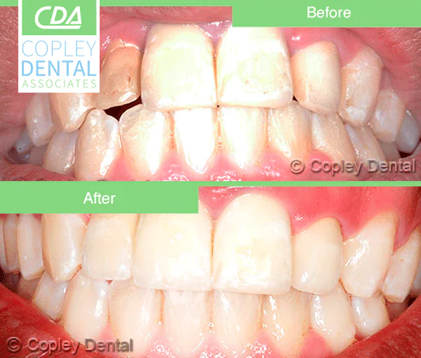 CASE 31: Cosmetic Restoration
